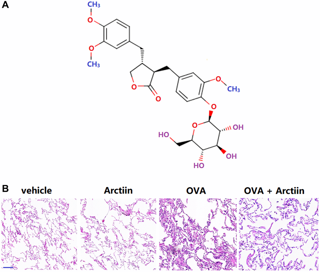 Arctiin attenuated ovalbumin (OVA)-challenged lung pathological alterations. C57BL/6 mice were divided into four groups: vehicle, Arctiin, OVA, and OVA+ Arctiin (10 mg/kg). (A) Molecular structure of Arctiin; (B) Lung histological changes were assessed using haematoxylin and eosin (HE) staining. Scale bar, 300 μm.