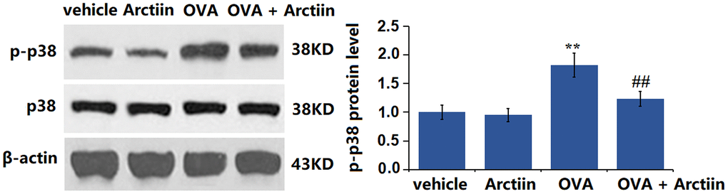 Arctiin prevented OVA-induced activation of p38 in lung tissues. C57BL/6 mice were divided into four groups: vehicle, Arctiin, OVA, and OVA+ Arctiin. The levels of p-p38 and total p38 were measured using western blot analysis (n = 12, **P ##P 