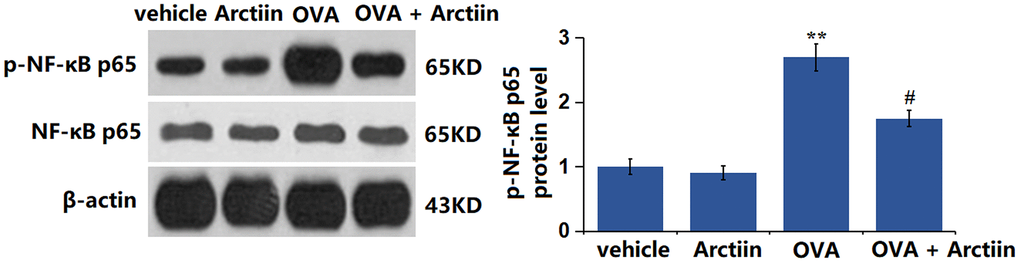 Arctiin prevented OVA-induced activation of NF-κB p65 in lung tissues. C57BL/6 mice were divided into four groups: vehicle, Arctiin, OVA, and OVA+ Arctiin. The levels of p-NF-κB p65 were measured using western blot analysis (n = 12, **P ##P 